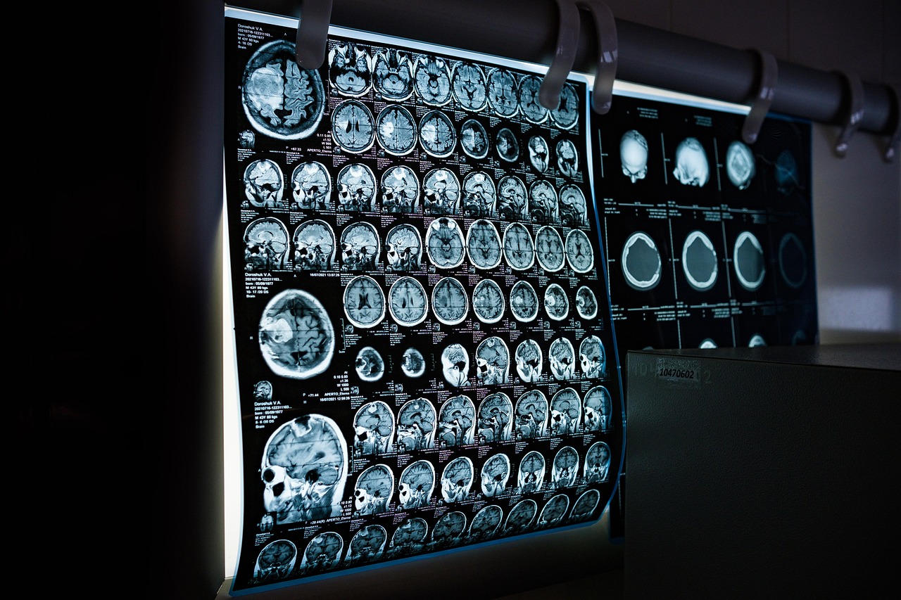 ct scan image